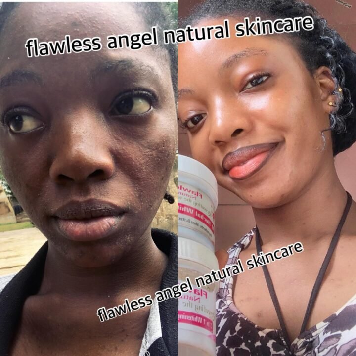 review shock  E dey work ohhh  
see Glowing skin ,sweet pink lip , dark spot com…