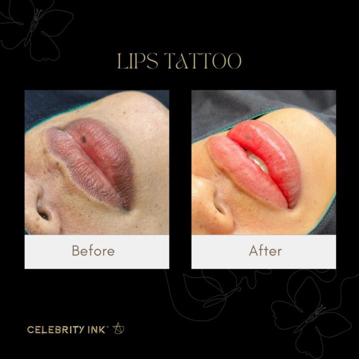 Professional Lips Tattoo, Getting a natural, glossy lip blush tattoo for soft co…