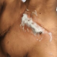 #tattoo #tattoos #tat #toptags #ink inked tattooed tattoist coverup art design i…